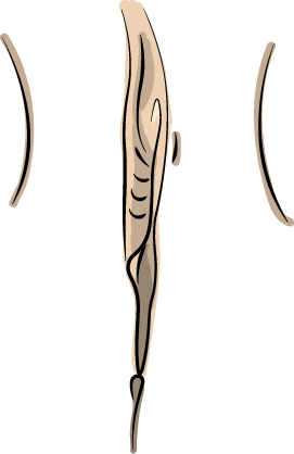 labioplastia